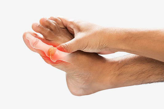 Gicht: Ursachen, Symptome und bewährte Maßnahmen zur Linderung